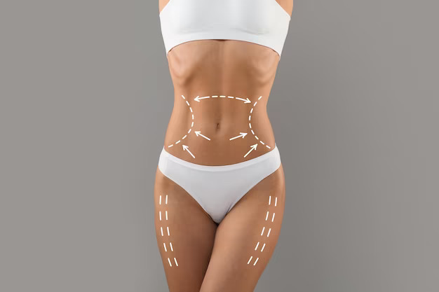 البودي كونتور وتنسيق القوام 1 1695124905body contouring slim female torso with drawn lifting up lines it 116547 27601