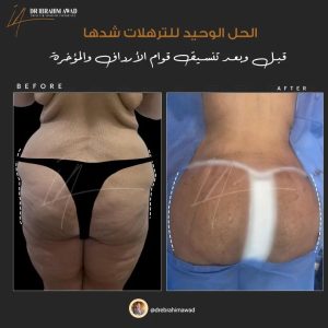 drebrahimawad 1731780846129