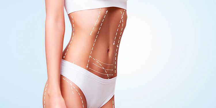 شفط الدهون بالفيزر 5 vaser lipo